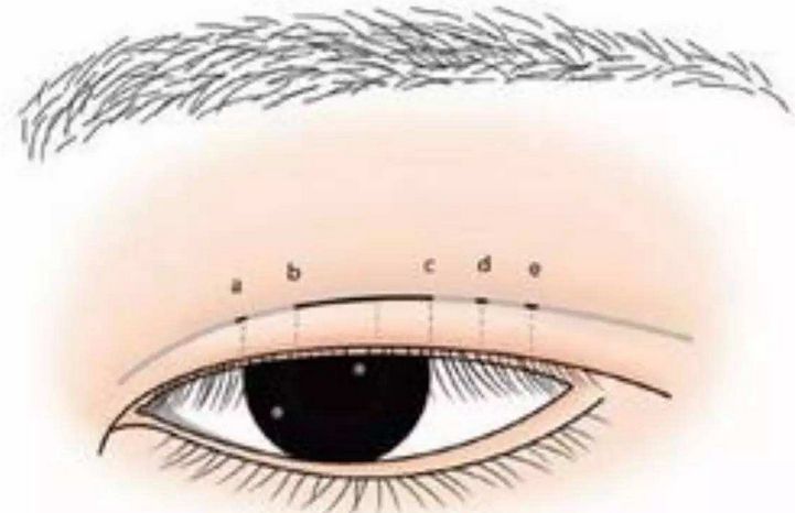 ���ͺ��������p��Ƥ�g(sh��)����Ҫע��ʲô��