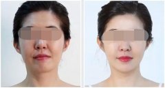 �沿Óë��Ҫע����Щ���(xi��ng)