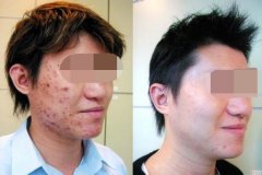 ���ͺ����ļ��t(y��)Ժȥ��̥ӛЧ����?