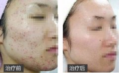 ����Q�w��һ�ζ����X?