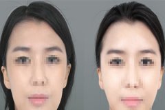 ˮ��ᘵĹ�Ч����Щ?