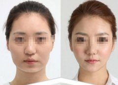 ���ͺ���ע����Ęᘶ����X��