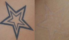 ���ͺ��ؼ���ϴ�y����Ҫ�����X?