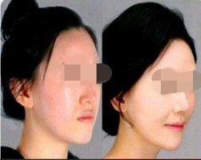 �O������ʲô?