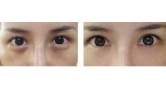 ���������t(y��)Ժ�������Ȧ��ô��