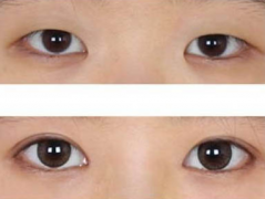 ���ͺ����������t(y��)Ժ���_�۽����g(sh��)�����X��