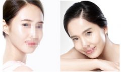 ע���O���������X?