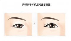 �_�۽����g(sh��)������ʲô��̎����