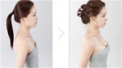 ���ͺ��������w֬���S�����g(sh��)��Ҫע����Щ���?