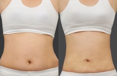 ���ͺ����ļ��t(y��)Ժ��������֬Ч����?