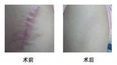 ���ͺ��ؼ������Ч����ô��?