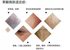 ���ͺ��ع���Q�wЧ�����?