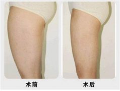 ���ͺ��ش��ȳ�֬�ö����X?