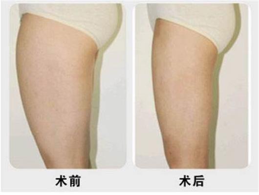 ������֬