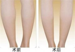 ���ͺ����ļ��t(y��)Ժ���Ȳ���֬Ч����?