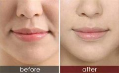 ���ͺ����������������y�����X?