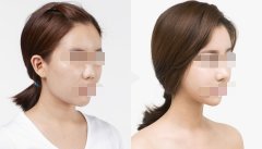 ���ͺ�������ܛ��¡��Ч����ô��?