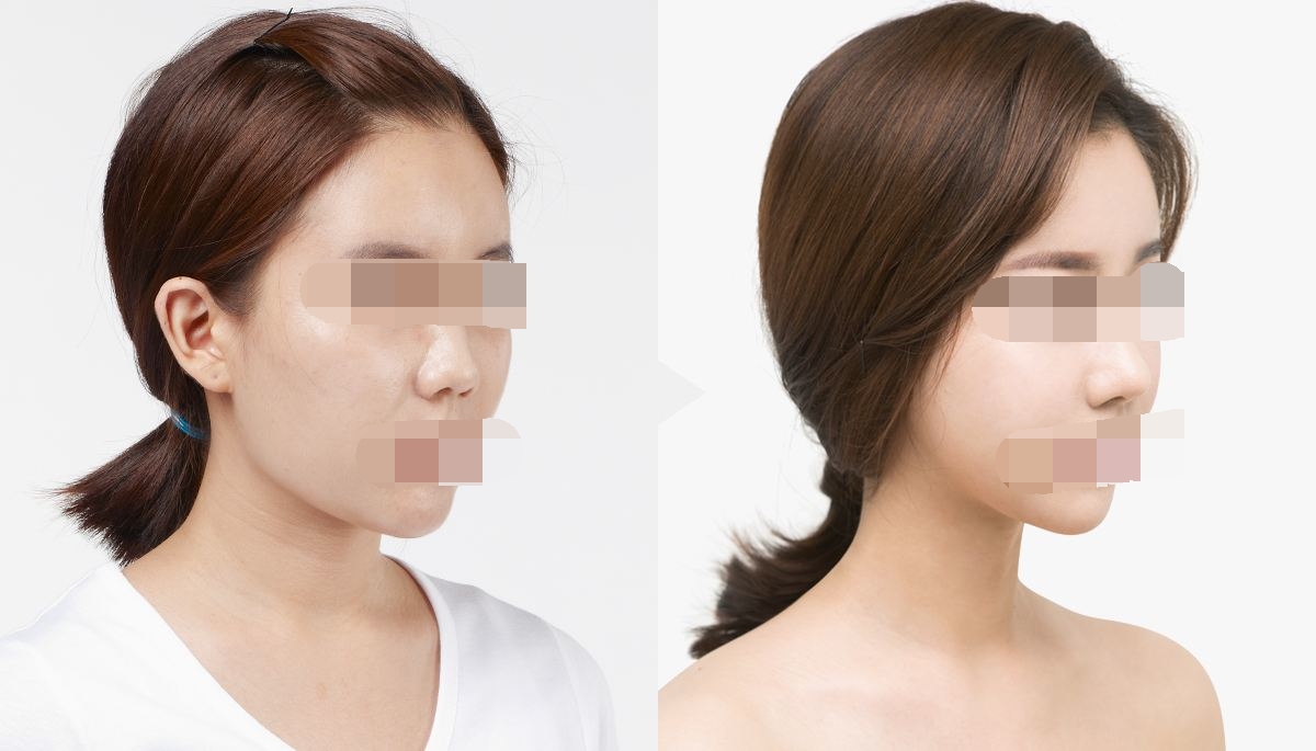 ���ͺ�������ܛ��¡��Ч����ô��