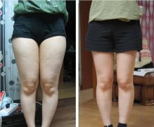 ���ͺ������Ȳ���֬���g(sh��)�����X?