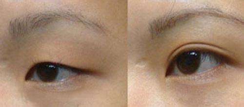 ���ͺ����ļ��t(y��)Ժ���p��Ƥ����Ч����