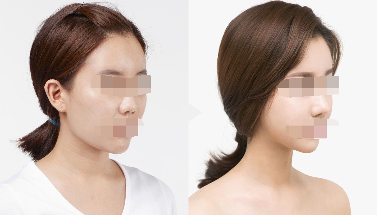 ���ͺ�����¡�����g(sh��)�����X