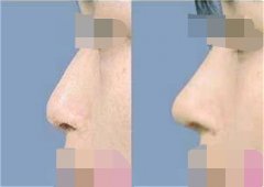 ���ͺ����ļ��t(y��)Ժ�����w¡��Ч����?