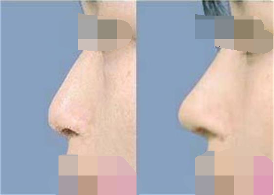 ���ͺ����ļ��t(y��)Ժ�����w¡��Ч����