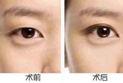 ���ͺ�����ȫ���p��Ƥ�����X?