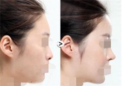 ���ͺ��ؼ��w¡�����g(sh��)�����X?