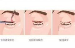 �p��Ƥ�ޏ�(f��)���g(sh��)�����X?