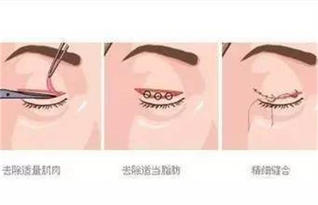 �p��Ƥ�ޏ����g(sh��)�����X