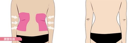 ���ͺ�������������֬�����X