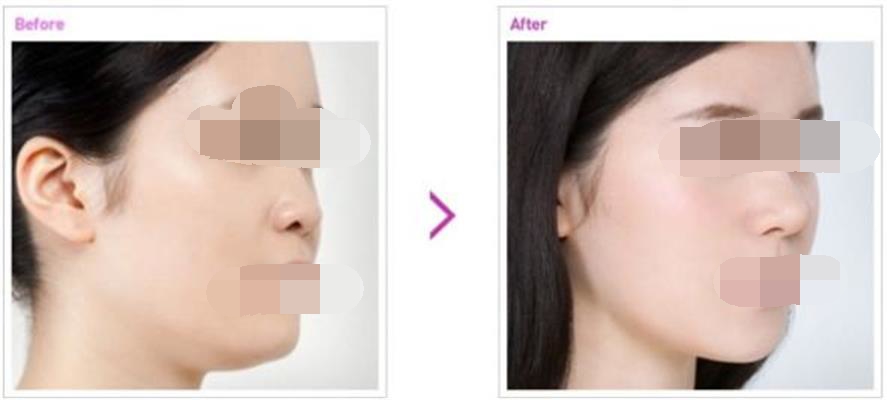 ���ͺ����ļ��t(y��)Ժ��¡���ޏ�(f��)Ч����ô��