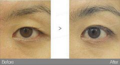 ���ͺ������p��Ƥ���_�۽Ƕ����X?