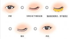 ���ͺ������۴����g(sh��)�����X?