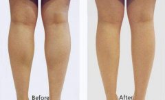 ���ͺ����ļ��t(y��)Ժע������Ч����?