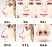 ¡���g(sh��)Ч���ò�����