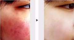 �tѪ�z�����_