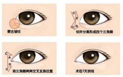 �����_�۽����g(sh��)��Ӱ푺��z�Y����