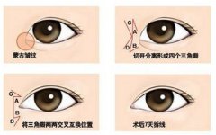 ��ʲô�۾��������󲻉�������