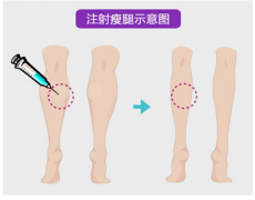 ���ͺ���ע������ᘴ�Ŷ����X(qi��n)?