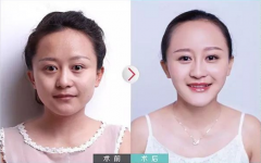 ��������䷨��y��ȫ����