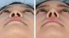 ���ͺ��س���ǳC���g(sh��)������o����