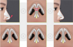 ���ͺ���¡�ǳ��õĲ�������Щ����