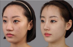 ¡�Ǻ�Ч���挍(sh��)�᣿