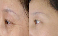 �沿���y��ˮ���a(b��)ˮ�a(b��)ˮЧ���ò���?