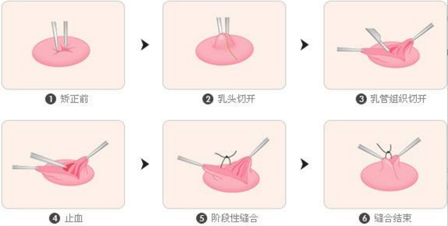 ΢�ňDƬ_20190612113209