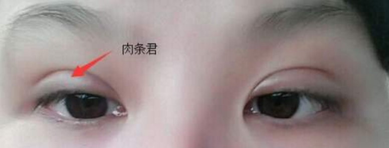 ���ͺ��������p��Ƥ�g(sh��)���ʲô�����F(xi��n)�D�c��