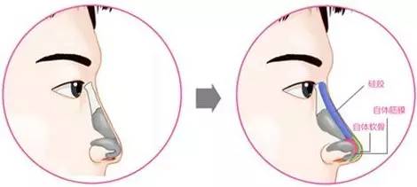 ���wܛ��¡�ǵ�Ч����ô��