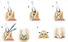 ���ͺ��ؼ��w¡�ǎ�ʮ������ô����